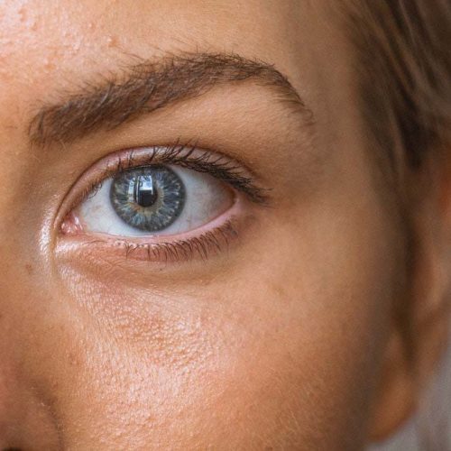 Beauty is in the eye of the beholders Part I : ogen en Botox